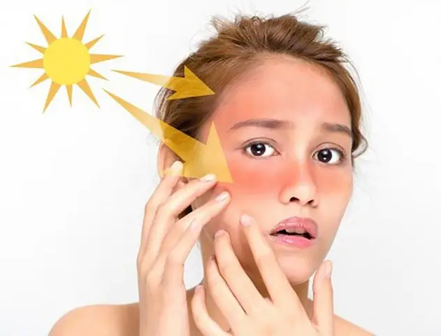 10 Cách Bảo Vệ Làn Da Dưới Nắng Hè