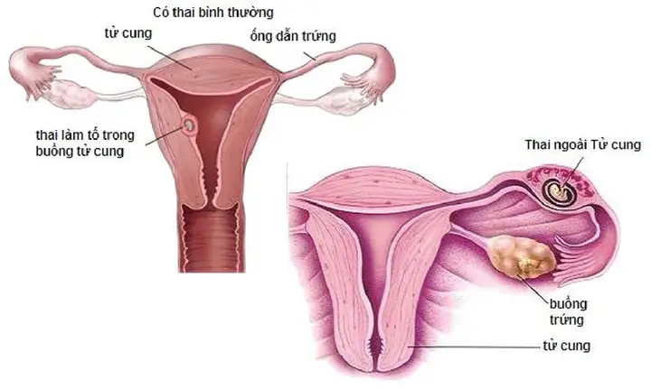 Tuần Đã Có Tim Thai Chưa