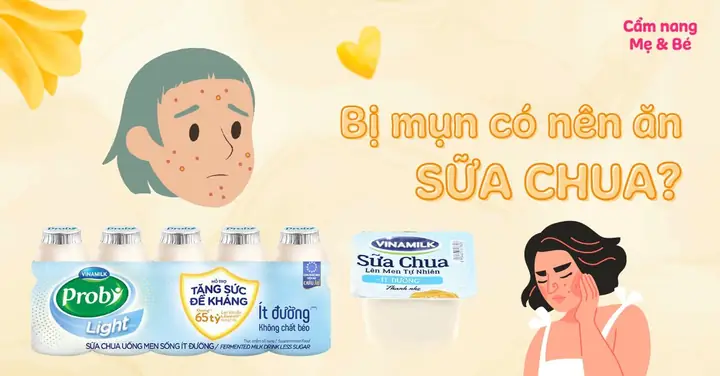 Ăn Sữa Chua Có Trị Mụn Không