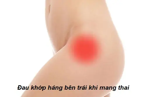 Bà Bầu Bị Đau Khớp Háng Bên Trái