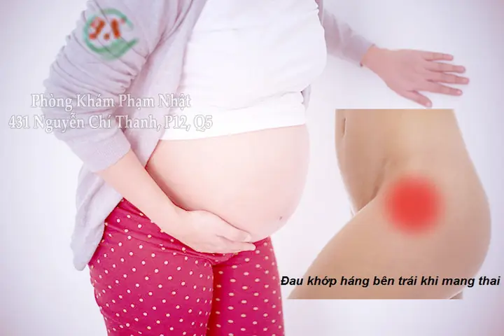 Bà Bầu Bị Đau Khớp Háng Bên Trái