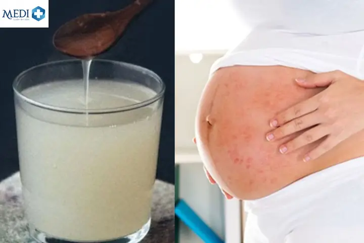 Bà Bầu Có Được Ăn Sắn Dây Luộc Không