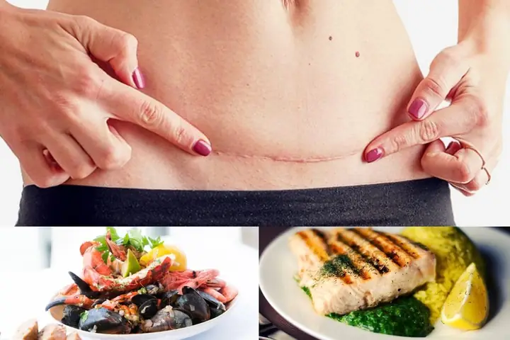 Bà Đẻ Bao Lâu Được Ăn Hải Sản
