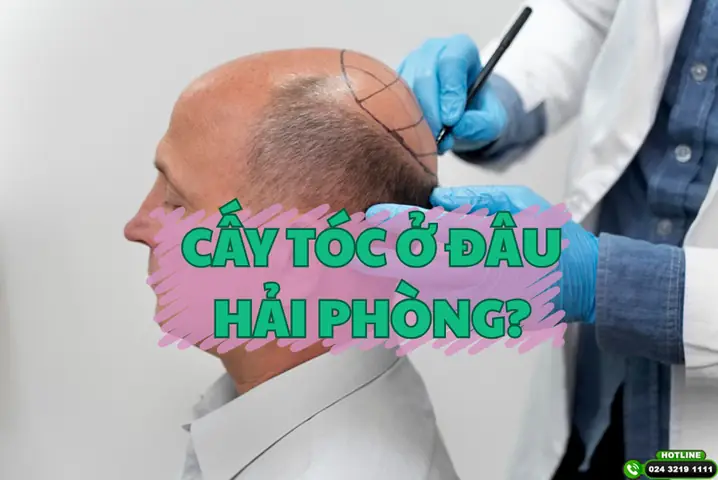 Bác Sĩ Chữa Viêm Tai Giữa Giỏi Ở Hải Phòng