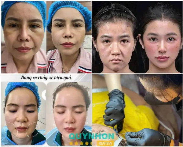 Bác Sĩ Hà Văn Hùng Quy Nhơn