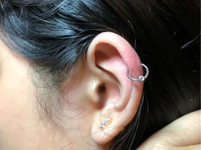 Bấm Lỗ Tai Ở Bệnh Viện Vinmec