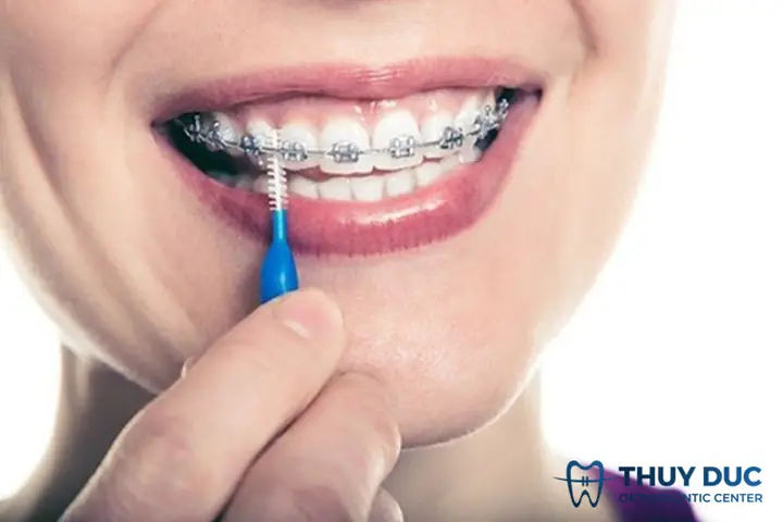 Bàn Chải Kẽ Răng Loại Nào Tốt