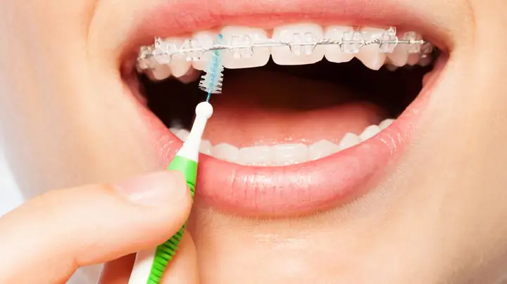 Bàn Chải Kẽ Răng Loại Nào Tốt