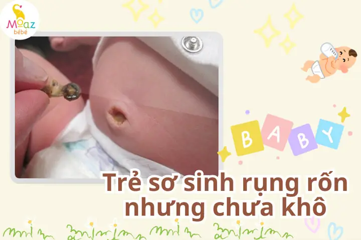 Bao Lâu Trẻ Sơ Sinh Rụng Rốn Bao Lâu Trẻ Sơ Sinh Rụng Rốn