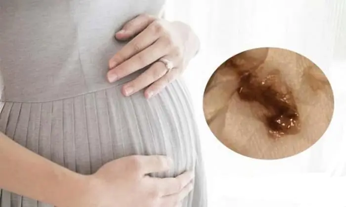 Bầu 3 Tháng Đầu Bị Ra Dịch Màu Nâu