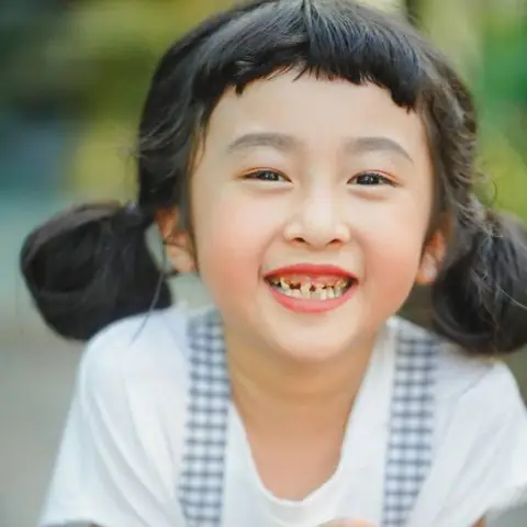 Bé 1 Tuổi Bị Sún Răng