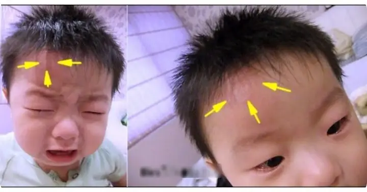Bé 2 Tuổi Bị Té Đập Đầu Xuống Đất