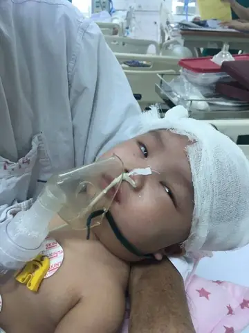 Bé 3 Tháng Bị Té Võng