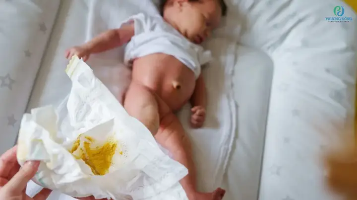 Bé 3 Tháng Đi Ngoài Nhiều Lần Trong Ngày