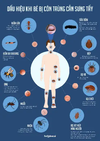 Bé Bị Muỗi Cắn Sưng Đỏ