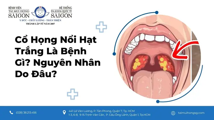 Bé Bị Nổi Hạt Trong Họng
