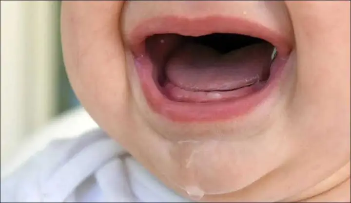 Bé Mọc Răng Bị Sốt Và Tiêu Chảy Bé Mọc Răng Bị Sốt Và Tiêu Chảy
