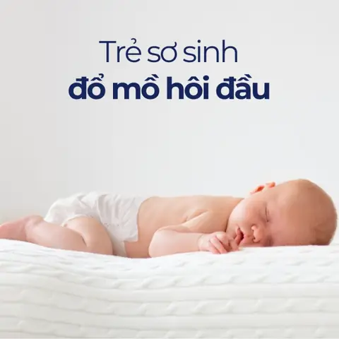 Bé Sơ Sinh Bị Đổ Mồ Hôi Đầu