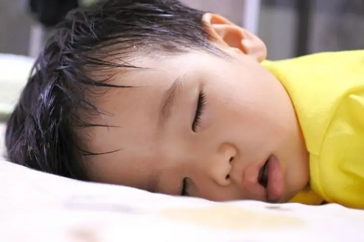 Bé Sơ Sinh Bị Đổ Mồ Hôi Đầu