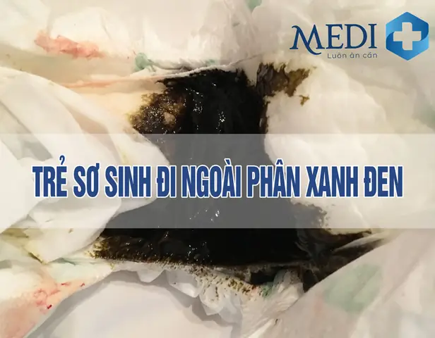 Be So Sinh Di Ngoai Phan Mau Xanh Be So Sinh Di Ngoai Phan Mau Xanh