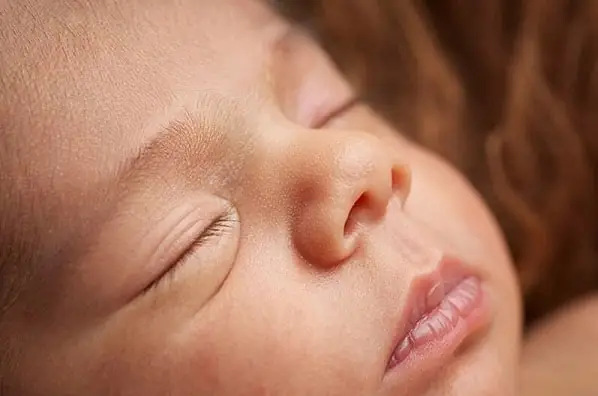 Bị Khô Môi Phải Làm Sao