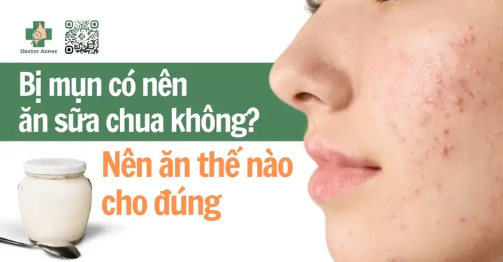 Bị Mụn Có Nên Ăn Sữa Chua