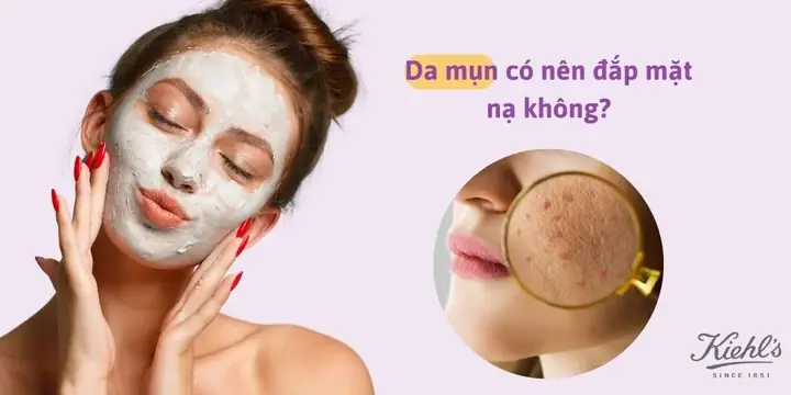 Bị Mụn Có Nên Đắp Mặt Nạ Không