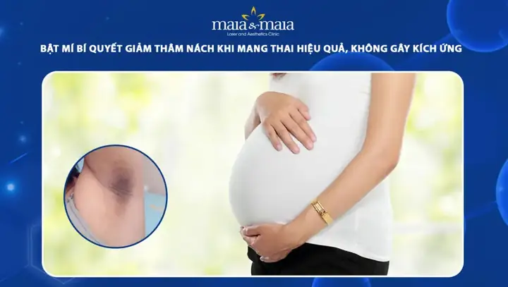 Bị Thâm Nách Khi Mang Thai Bị Thâm Nách Khi Mang Thai