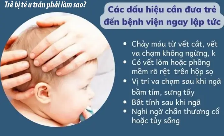 Bị U Đầu Phải Làm Sao