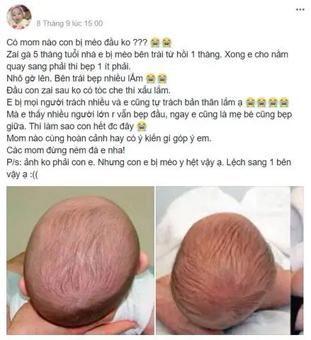 Bị U Đầu Phải Làm Sao