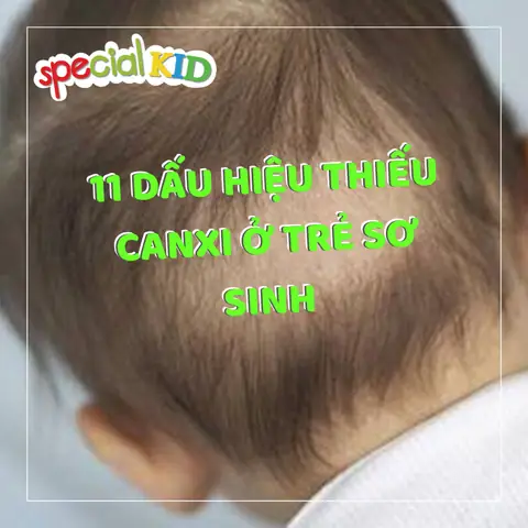 Biểu Hiện Trẻ Em Thiếu Canxi