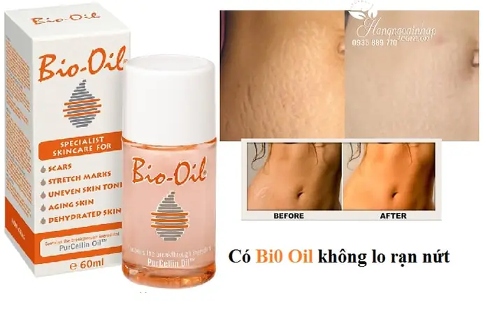 Bio Oil Có Tác Dụng Gì