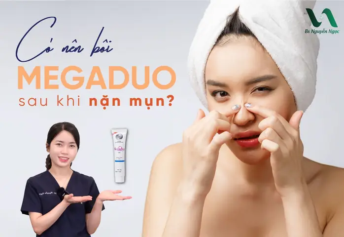 Bôi Gì Sau Khi Nặn Mụn