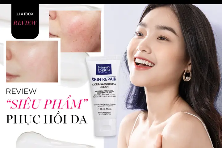 Bôi Gì Sau Khi Nặn Mụn