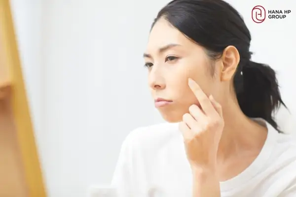 Bôi Kem Dưỡng Da Bị Châm Chích Bôi Kem Dưỡng Da Bị Châm Chích