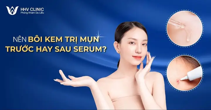 Bôi Kem Trị Mụn Trước Hay Sau Serum