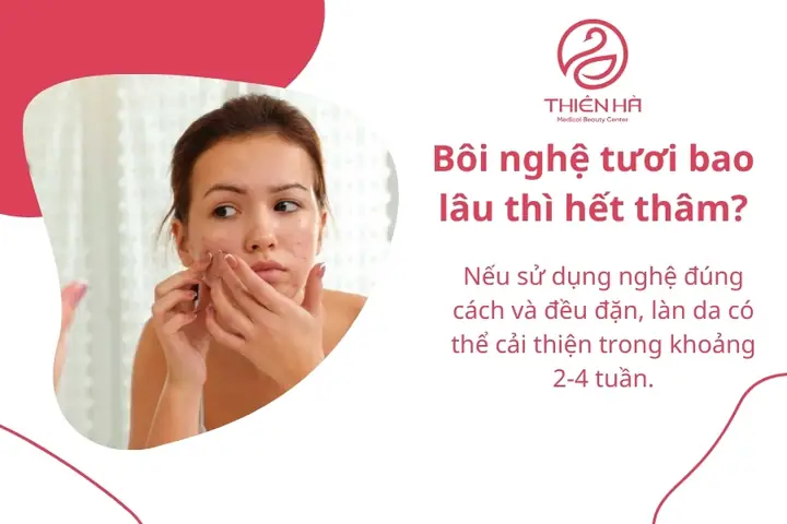 Bôi Nghệ Bao Lâu Thì Hết Thâm