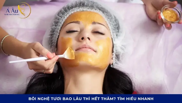 Bôi Nghệ Bao Lâu Thì Hết Thâm