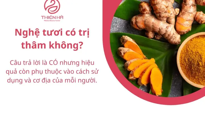 Bôi Nghệ Bao Lâu Thì Hết Thâm