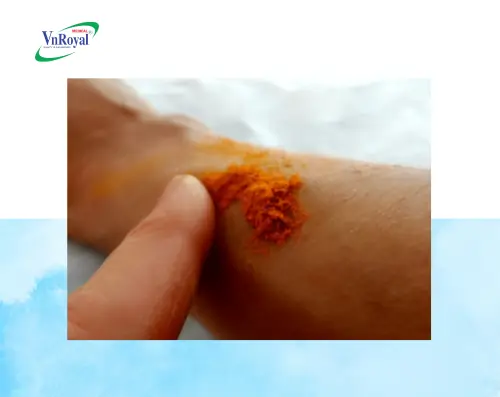 Bôi Nghệ Có Bị Thâm Không