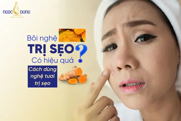 Bôi Nghệ Có Bị Thâm Không