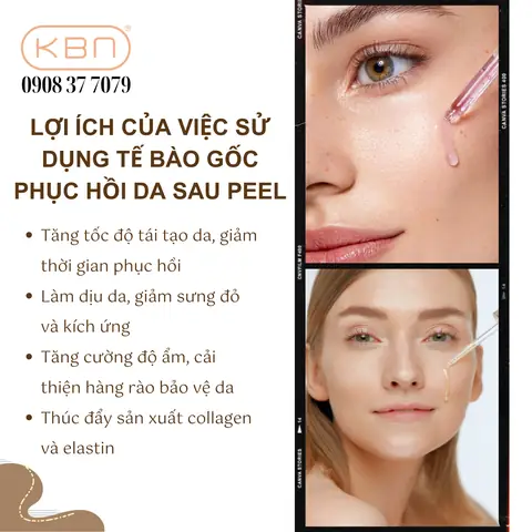 Bôi Tế Bào Gốc Sau Phi Kim