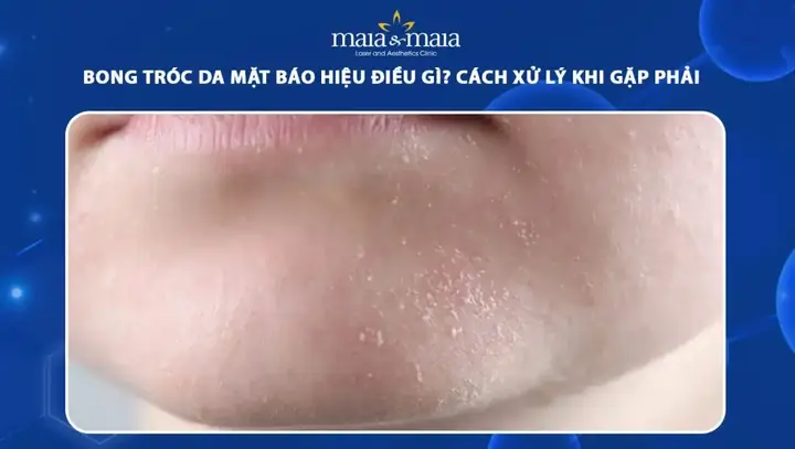 Bong Tróc Da Mặt Là Bệnh Gì