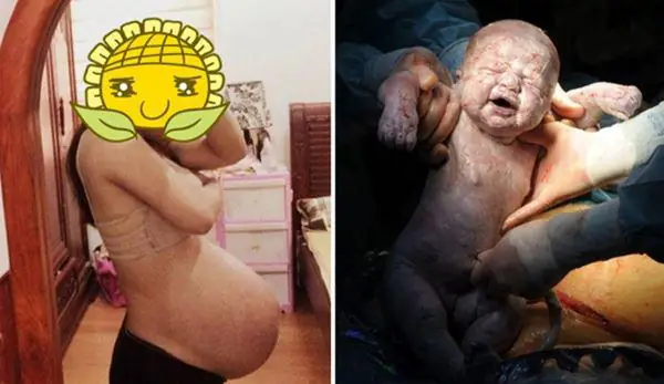 Bụng Như Thế Nào Là Tụt