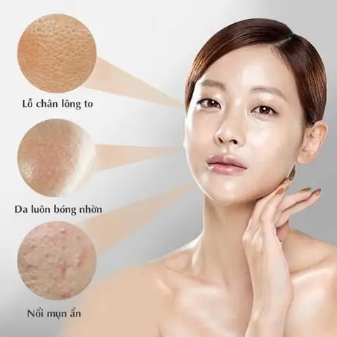 Các Bước Chăm Sóc Da Dầu Cơ Bản