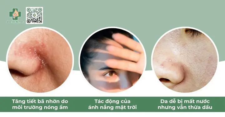 Các Bước Chăm Sóc Da Dầu Mụn Mùa Hè