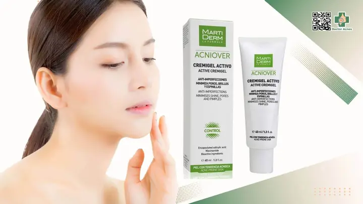 Các Loại Kem Dưỡng Ẩm Tốt Cho Da Dầu Mụn