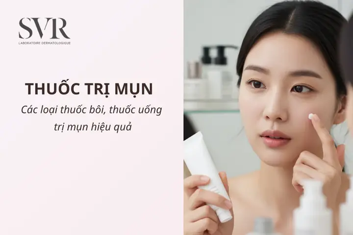 Các Loại Mỹ Phẩm Trị Mụn Hiệu Quả