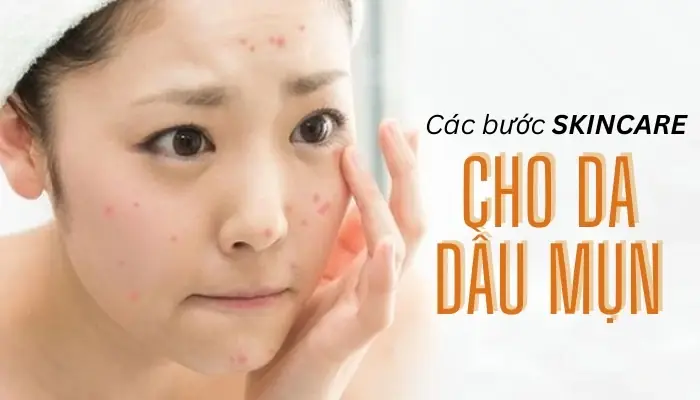 Các Thương Hiệu Trị Mụn Nổi Tiếng