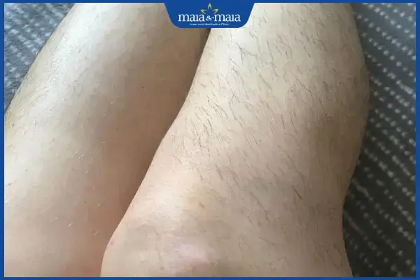 Cách Cạo Lông Nách Không Mọc Lại